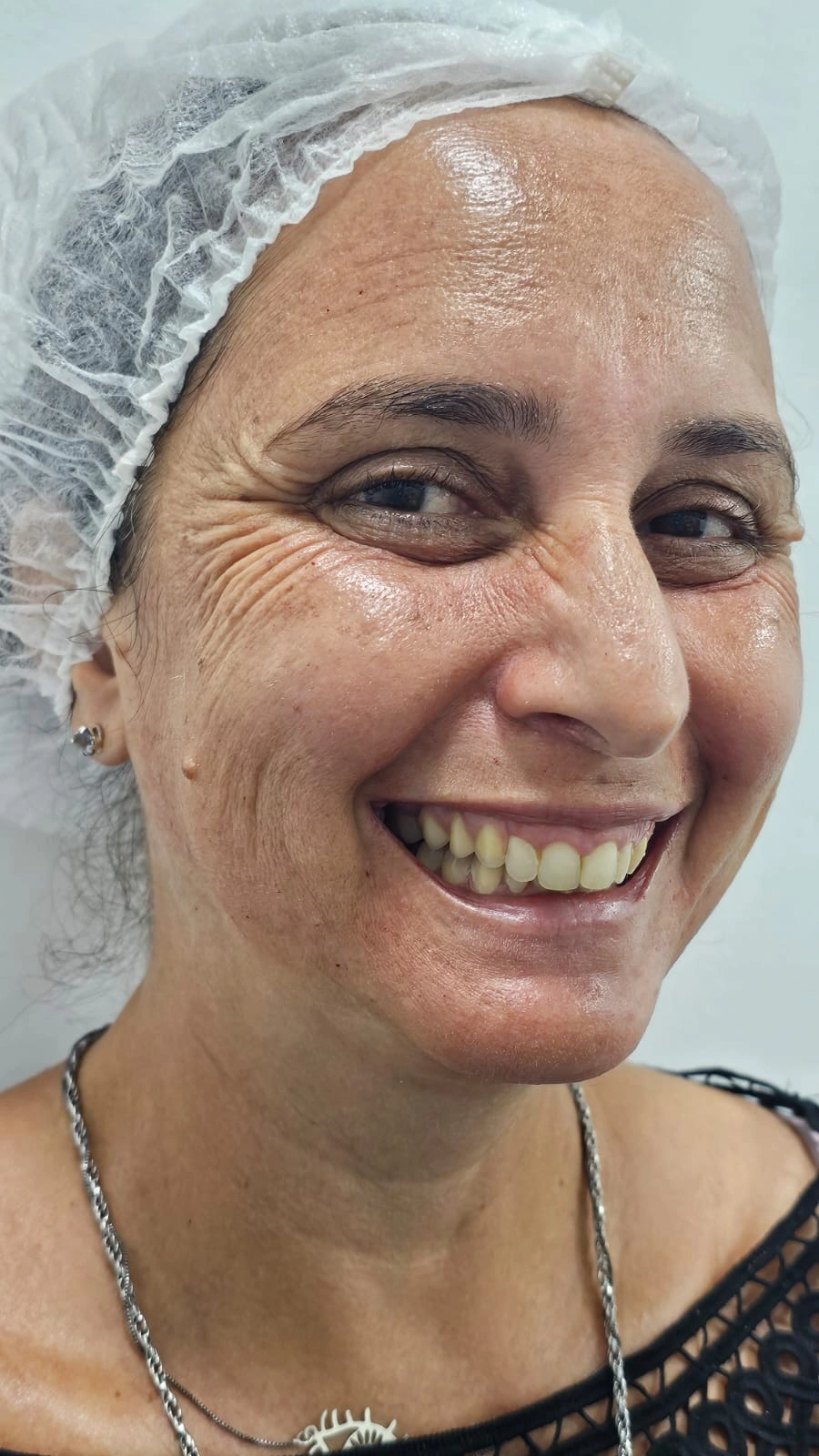Antes do tratamento