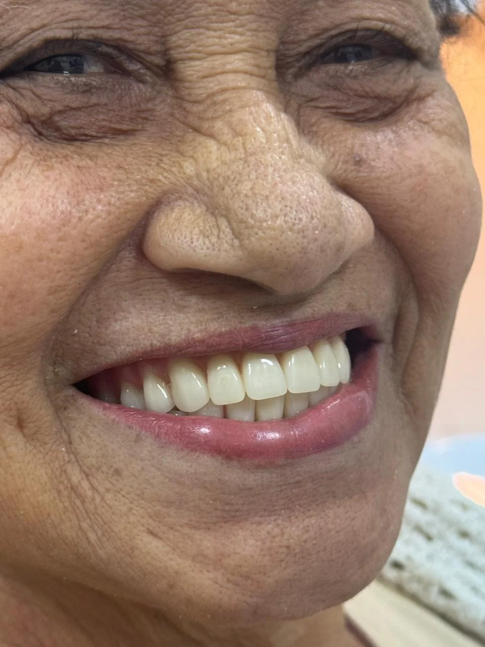 Depois do tratamento